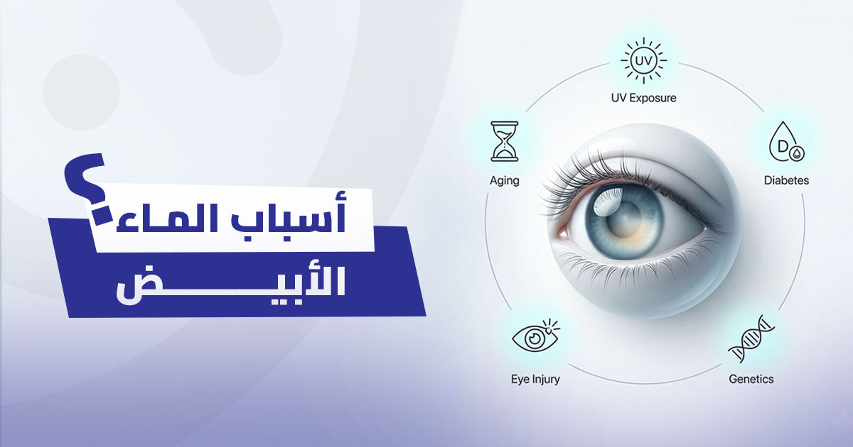 أسباب الماء الأبيض: هل هي مجرد تقدم في العمر أم أن هناك عوامل أخرى؟