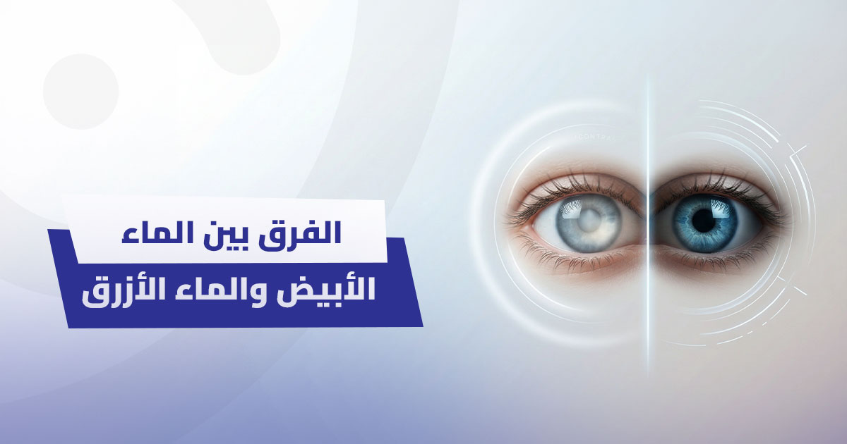 الفرق بين الماء الأبيض والماء الأزرق: دليل شامل لتصحيح المفاهيم