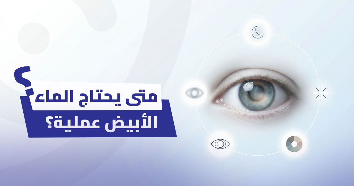 متى يحتاج الماء الأبيض عملية؟ 5 علامات تخبرك أن وقت الجراحة قد حان