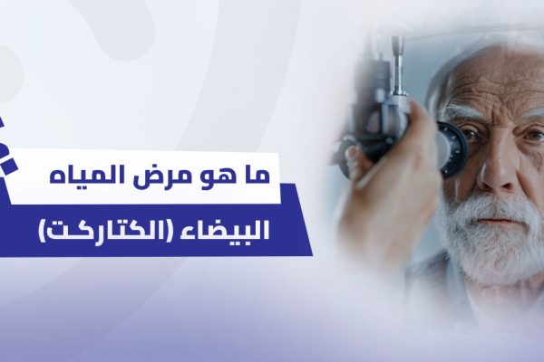 ما هو مرض المياه البيضاء (الكتاركت)؟