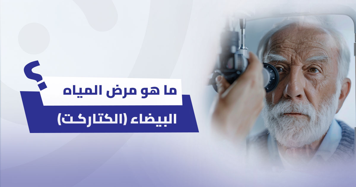 ما هو مرض المياه البيضاء (الكتاركت)؟