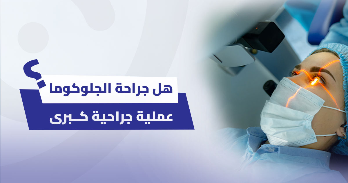 هل جراحة الجلوكوما عملية جراحية كبرى؟ دليل شامل للمرضى