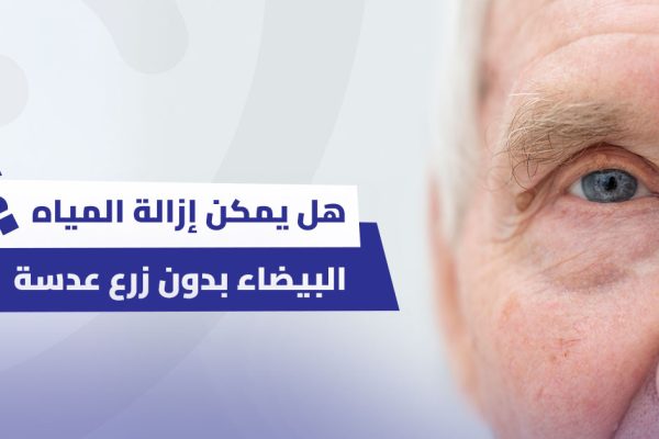 هل يمكن إزالة المياه البيضاء بدون زرع عدسة؟